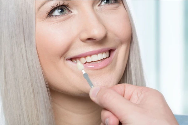 pros and cons of veneers